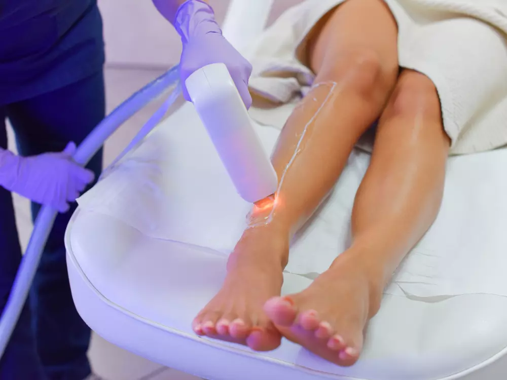 Laser Hair Removal
